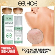 Eelhoe Back Acne Repair Spray Acne Mark Removal Pimple Scar Anti Itching Redness Oil Control Shrink 
