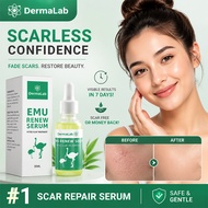 7 Days Scar Removal Dermalab Emu Renew Serum For Scar Treatment 300% Effective Safe For Skin