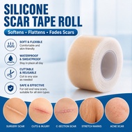 Medical Silicone Scar Sheet Roll | Reusable Scar Care Tape for C-Section, Acne & Burn Scars