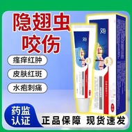 3.38 Readystock Readystock Hidden Wings Bites Mosquito Bites Skin Itching Red Swelling Ants Bites St