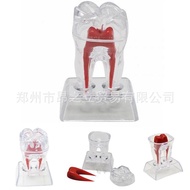 Dental Material Dental Model Single Large Dental Decomposable Dental Model Dental Mold Transparent D