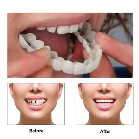 Perfect Fit Teeth Whitening Fake Tooth Cover Snap on Silicone Smile Veneers Teeth Flexibles Fake Tee