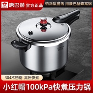 Kangbach Little Red Riding Hood Pressure Cooker 304 Stainless Steel Pressure Cooker Large Capacity Household Multi-Functional Explosion-Proof Universal