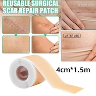Silicone Scar Sheet Silicone Scar Sheet Fades Scars Silicone Keloid Scar Patch Caesarean Section Sca