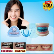 Teeth Trainer Straightening Teeth Without Braces Alighnment Teeth Teeth Trainer Orthopedic Retainer 