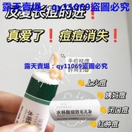 (滿299元出貨）臻羞水楊酸細緻毛孔霜改善黑頭閉口收縮毛孔嫩膚滋潤霜