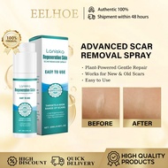 Advanced Scar Removal Spray, Scar Remove Spray 20ml  Acne Scar Removal/Acne Scar and Dark Spot Remov