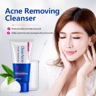 Mild oil control Acne Removing Cleanser Cream /facial face wash Removing acne and controlling oily s