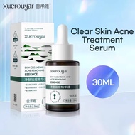 Salicylic acid anti-acne essence repairs acne pits and fades acne marks and scars,Azelaic acid remov
