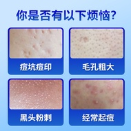 Japan imported Shiseido IHADA acne and anti-inflammatory cream to relieve inflammation and mild acne