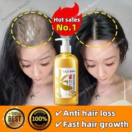 Hair loss shampoo-Hair growth shampoo-Ginger shampoo 500ML Anti hair loss/Fast hair growth/Anti dandruff/Control oil