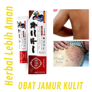 [Yiganerjin Obat Cina]Salep Gatal Kurap Menahun Obat Jamur Paling Ampuh Di Kulit Lipatan Ketiak Paha