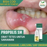 Obat Sariawan Bibir Perih - Obat Sariawan Lidah Alami Obat Luka Sariawan Sariawan Sudut Bibir Bibir