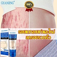 Guanjing Stretch mark cream Stretch marks 80g, relieve stretch marks, reduce stretch marks, legs, st