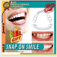 Gigi Palsu Snap on Smile On Smile 100% ORIGINAL Authentic
