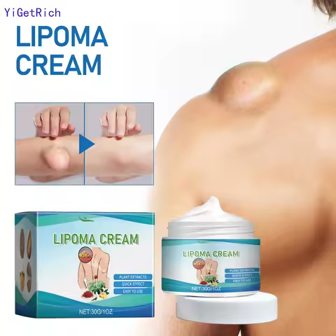 Lipoma Ointment, Lipoma Removal Paste Natural Herbal Lipoma Lump Removal Paste Lipoma Removal Paste