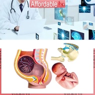 GLO Pregnant Pelvis Model Female Pelvis with  9 Months Baby Fetus Model