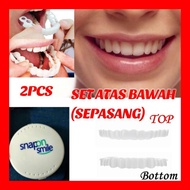 SNAP ON SMILE ATAS BAWAH (FULL SET)