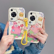 Be suitable for Huawei nova Y72,Y72S,Y63,4G,phone case ,MGA-LX3,GFY-LX1, popular new exquisite trend
