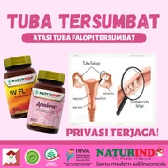 Promo Obat Tuba Falopi Tersumbat Penyumbatan Saluran Tuba Fallopi