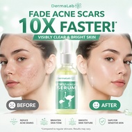 Dermalab Emu Renew Serum 30ml For All Skin Types Pitted Scar Treatment Moisturizing Scar Removal Cre