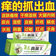 Herbal Fungus King Fast Anti-itching Skin Itching Whole Body Dry Itching Anti-itching Cream Skin Itc