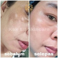 💕Organic Skincare Sets 3 in 1 Kak Ell💕