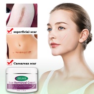 Scar Removal Cream scar remover for old scar on legs pimple marks remover peklat remover cream origi