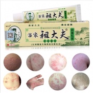 itching cream zudaifu Obat Kulit Gatal Jerawat Ruam Jamur Kudis Kurap krim hijau original