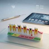Tooth Model, Human Dental Anatomy Model, Decorative Anatomical Tooth Model, Suitable For Home, Offic