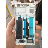 Oppo r7s blacket bone