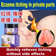 Private parts antifungal cream anti itch cream eczema cream and psoriasis anti itch cream Private antibacterial cream30g