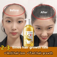 Hair loss shampoo-Hair growth shampoo-Hair Tonic For Hair Growth-Ginger shampoo 500ML Anti hair loss Fast hair growth Control oil Relieve itching Moisturizing Hair Growth