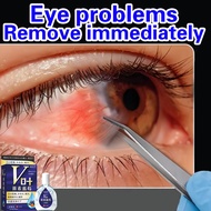 Eye drop Japan eye drops for dry eyes blueberry lutein relieves eye fatigue and blurred vision dilut