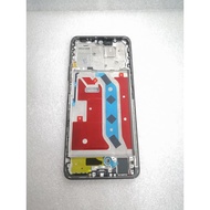 45 Online Compatible For Honor X9 Lcd Frame Middle Frame