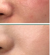 Somebymi Aha Bha Pha 30 Days Miracle Toner