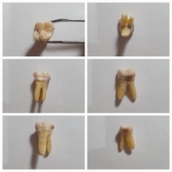 Upper Right Molar Practical Teeth (16) Original Graham Upper Right Teeth/