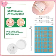 【Z*Star】 1/2 Set Ingrown Toenail Corrector Tools Pedicure Recover Embed Toenail Treatment Profession