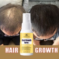 LYDIMOON Hair growth spray 30ml Anti-hair loss Promote hair growth Hair Tonic