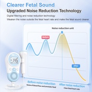 Cofoe Fetal Heart Rate Doppler Detector for Baby Ultrasound Pregnant Medical No Radiation Fetal Rate