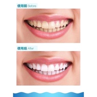 {G19} [READY STOCK] TOOTH WHITENING SYSTEM -