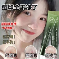 【店铺】祛痘膏去痘印青春痘粉刺收缩毛孔霜修复淡化痘坑男女学生祛痘神器