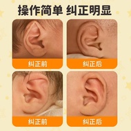 Newborn Ear Corrector Baby Ear Clip Silicone Ear Holder Outer Ear Shaping Ear Sticker Children's Aur