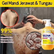 acne body wash Sabun jerawat punggung Sabun jerawat 500ml Remove mites and acne rejuvenation jerawat