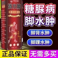 [Ready Stock] Diabetes Middle-aged Elderly People's Feet Edema Foot Edema Leg Edema Floating Edema L