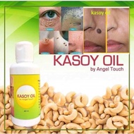 (OLD) Kasoy Oil