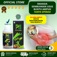 Obat Usus Buntu Tanpa Operasi Obat Usus Buntu Kronis Usus Buntu Meradang Obat Usus Buntu Pecah Denga