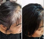 韓國黑髮活髮專家🇰🇷Scalp Anti-Aging防脫黑髮皇🧏🏻‍♀️