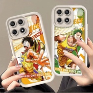 For Honor X6B Case Silicone Cartoon Pattern Soft TPU Shockproof Phone Casing For Honor X6B Case Back