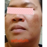 KRIM JERAGAT AMPUH BERKESAN dengan 1 set penggunaan ( skincare pr cosmetic)